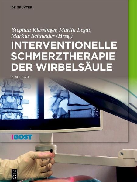 Produktbild: Interventionelle Schmerztherapie der Wirbels&auml;ule