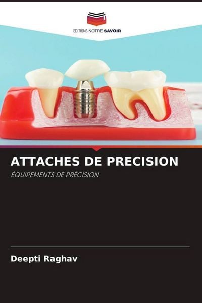 Produktbild: Attaches De Precision