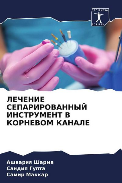 Produktbild: Lechenie Separirovannyj Instrument V Kornevom Kanale
