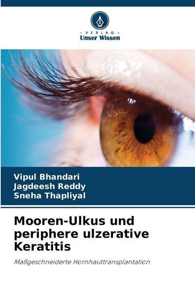 Mooren-Ulkus und periphere ulzerative Keratitis, Taschenbuch von Vipul Bhandari , Jagdeesh Reddy , Sneha Thapliyal, Verlag Unser Wissen, 9786209215476