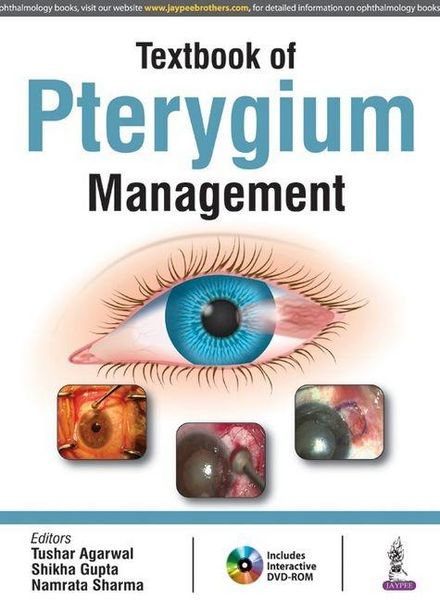 Produktbild: Textbook of Pterygium Management