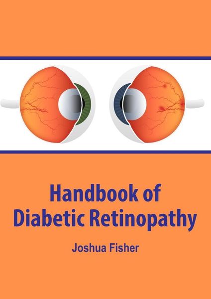 Produktbild: Handbook of Diabetic Retinopathy