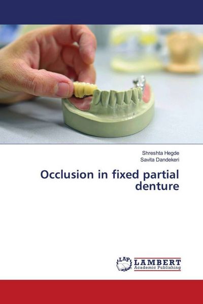 Produktbild: Occlusion in fixed partial denture
