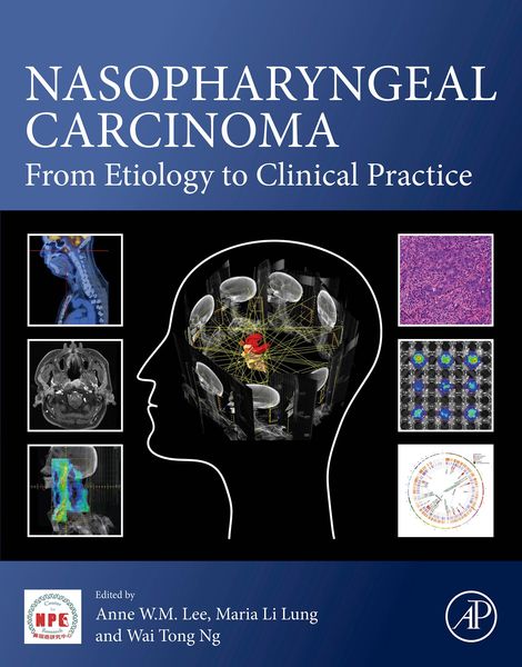 Produktbild: Nasopharyngeal Carcinoma