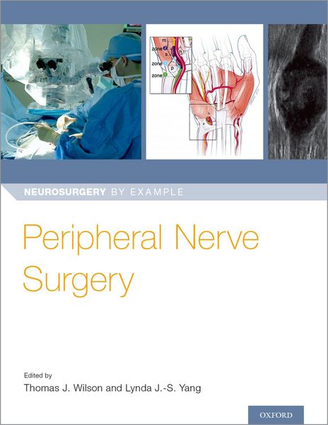 Produktbild: Peripheral Nerve Surgery