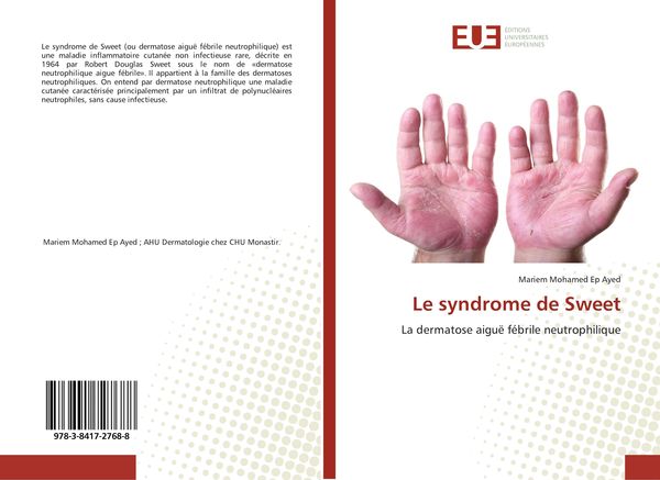 Produktbild: Le syndrome de Sweet