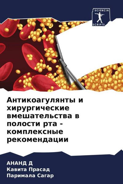 Produktbild: Antikoagulqnty i hirurgicheskie wmeshatel'stwa w polosti rta - komplexnye rekomendacii