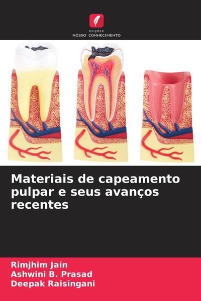 Produktbild: Materiais de capeamento pulpar e seus avan&ccedil;os recentes