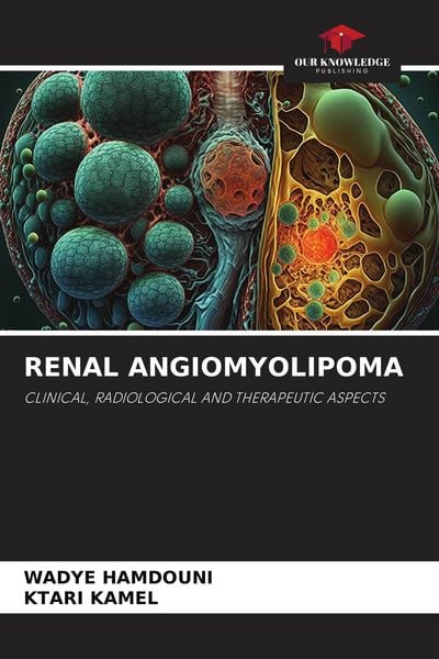 Produktbild: Renal Angiomyolipoma