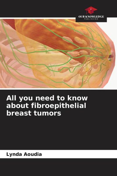 Produktbild: All you need to know about fibroepithelial breast tumors