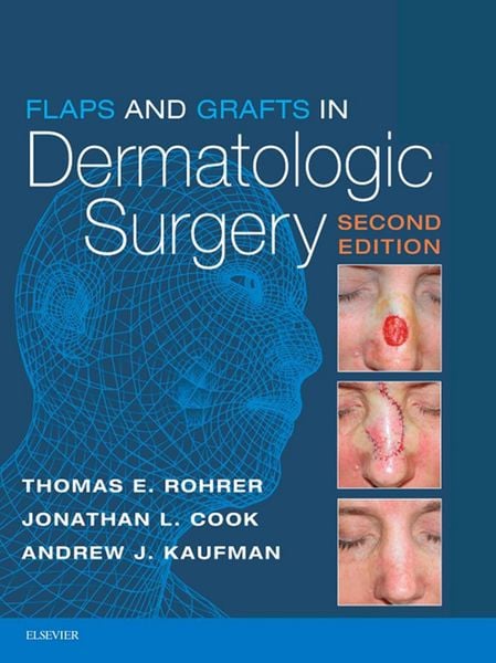 Produktbild: Flaps and Grafts in Dermatologic Surgery E-Book
