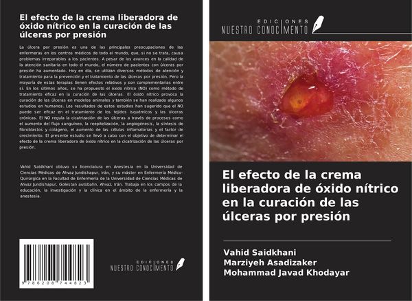 Produktbild: El efecto de la crema liberadora de &oacute;xido n&iacute;trico en la curaci&oacute;n de las &uacute;lceras por presi&oacute;n