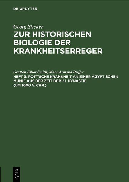 Produktbild: Pott'sche Krankheit an einer &auml;gyptischen Mumie aus der Zeit der 21. Dynastie (um 1000 v. Chr.)