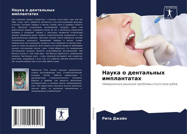 Produktbild: Nauka o dental'nyh implantatah