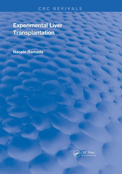 Produktbild: Experimental Liver Transplantation