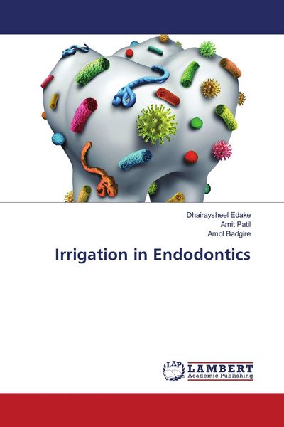 Produktbild: Irrigation in Endodontics