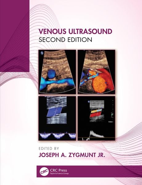 Produktbild: Venous Ultrasound