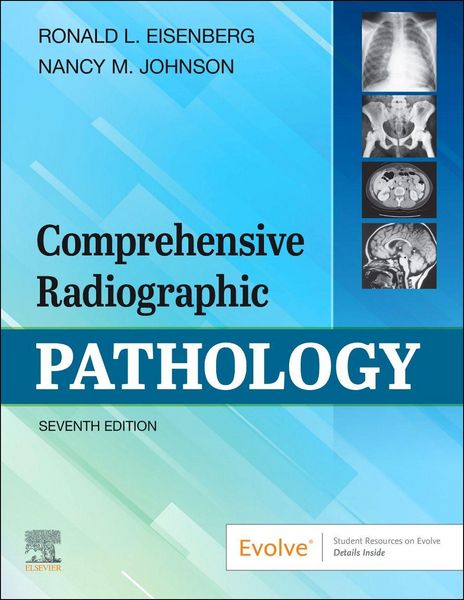 Produktbild: Comprehensive Radiographic Pathology E-Book