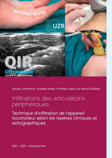 Produktbild: Infiltrations des articulations p&eacute;riph&eacute;riques