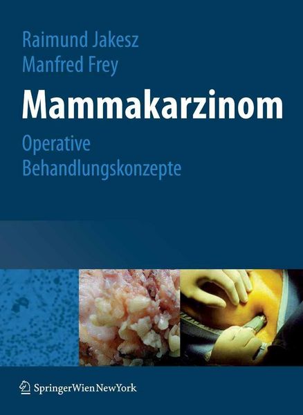 Produktbild: Mammakarzinom