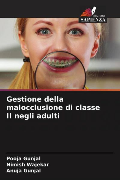 Produktbild: Gestione della malocclusione di classe II negli adulti