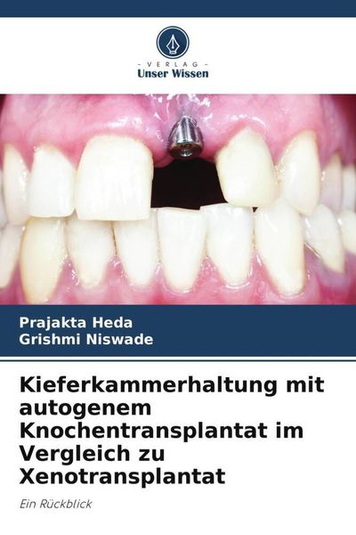 Produktbild: Kieferkammerhaltung mit autogenem Knochentransplantat im Vergleich zu Xenotransplantat