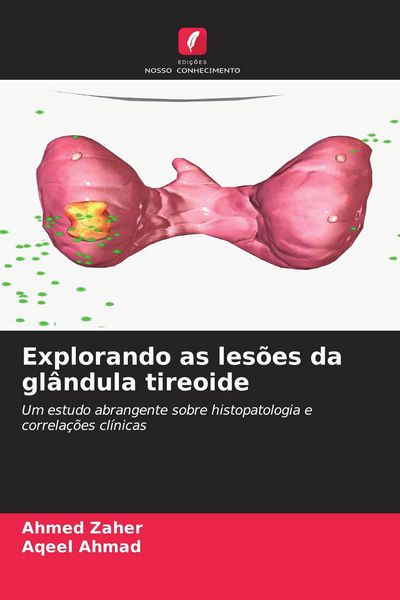 Produktbild: Explorando as les&otilde;es da gl&acirc;ndula tireoide