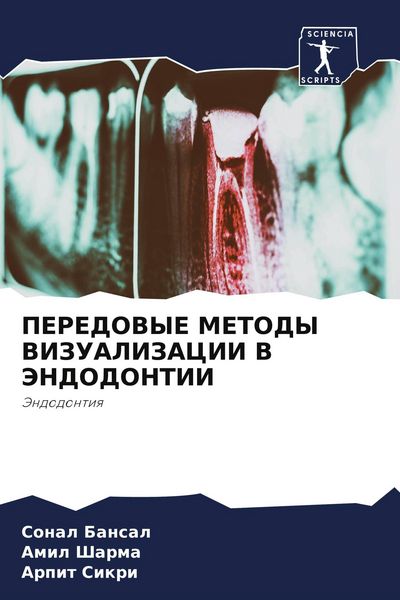 Produktbild: Peredovye Metody Vizualizacii V Jendodontii