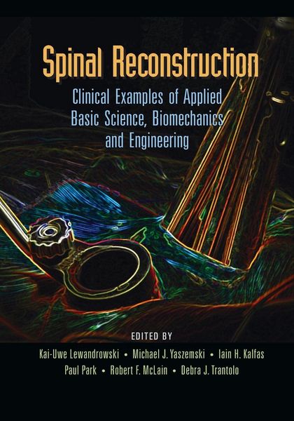 Produktbild: Spinal Reconstruction