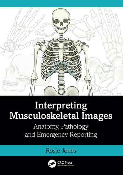 Produktbild: Interpreting Musculoskeletal Images