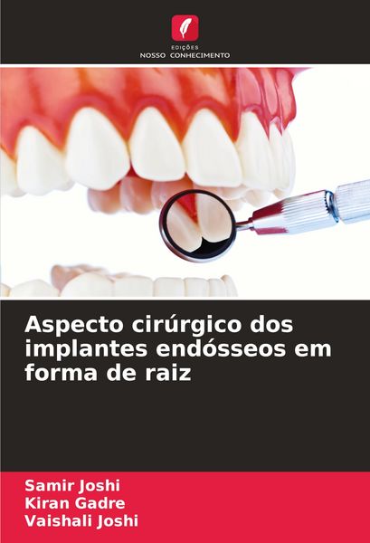 Produktbild: Aspecto cir&uacute;rgico dos implantes end&oacute;sseos em forma de raiz
