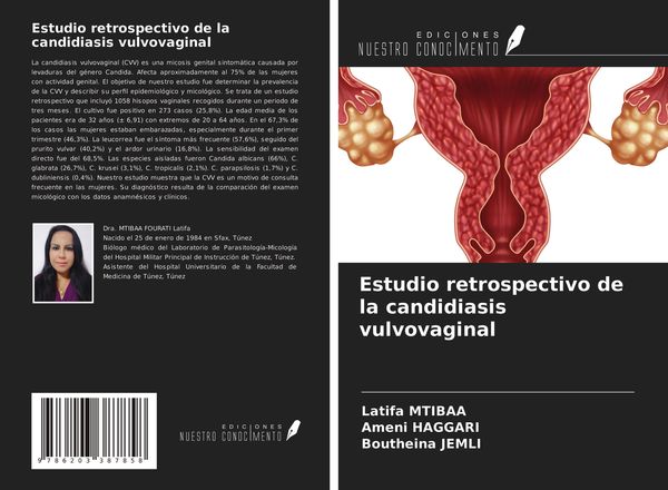 Produktbild: Estudio retrospectivo de la candidiasis vulvovaginal