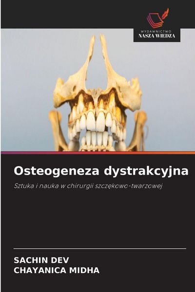 Produktbild: Osteogeneza dystrakcyjna