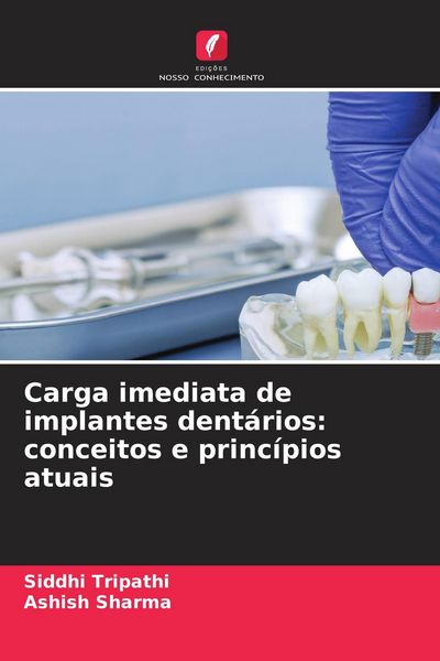 Produktbild: Carga imediata de implantes dent&aacute;rios: conceitos e princ&iacute;pios atuais