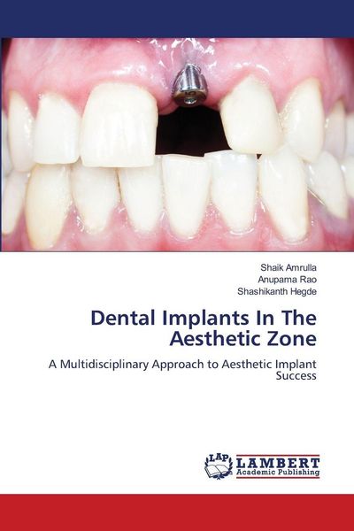Produktbild: Dental Implants In The Aesthetic Zone