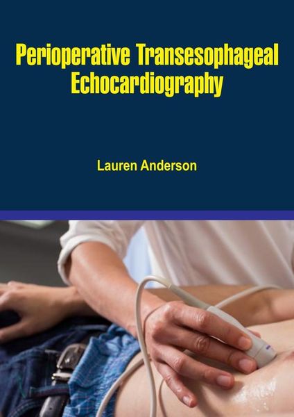 Produktbild: Perioperative Transesophageal Echocardiography