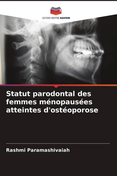 Produktbild: Statut parodontal des femmes m&eacute;nopaus&eacute;es atteintes d'ost&eacute;oporose