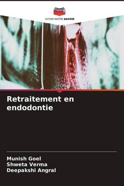 Produktbild: Retraitement en endodontie