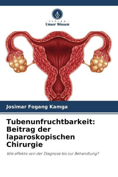 Tubenunfruchtbarkeit: Beitrag der laparoskopischen Chirurgie, Taschenbuch von Josimar Fogang Kamga, Verlag Unser Wissen, 9786203644401