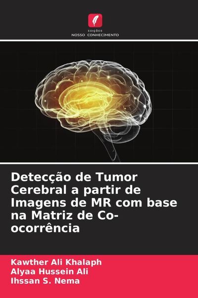 Produktbild: Detec&ccedil;&atilde;o de Tumor Cerebral a partir de Imagens de MR com base na Matriz de Co-ocorr&ecirc;ncia