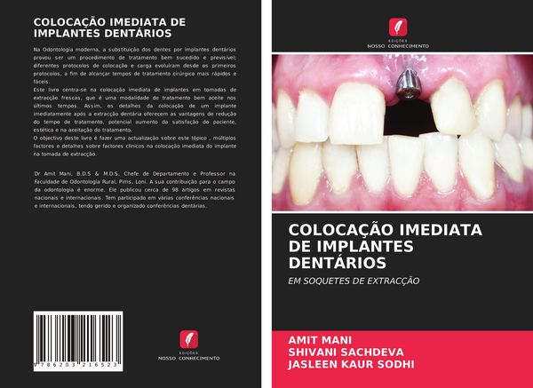 Produktbild: Coloca&ccedil;&atilde;o Imediata De Implantes Dent&aacute;rios