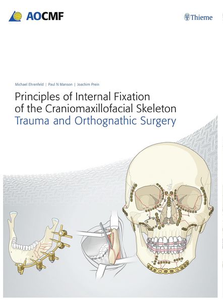 Produktbild: Principles of Internal Fixation of the Craniomaxillofacial Skeleton