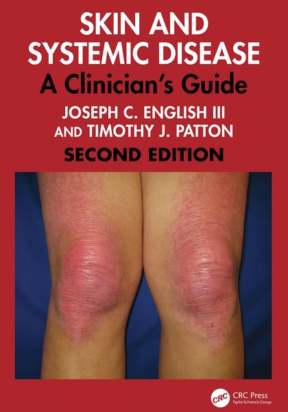 Produktbild: Skin and Systemic Disease
