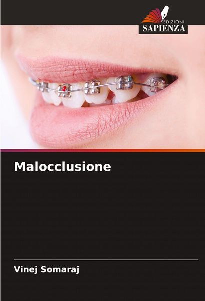 Produktbild: Malocclusione