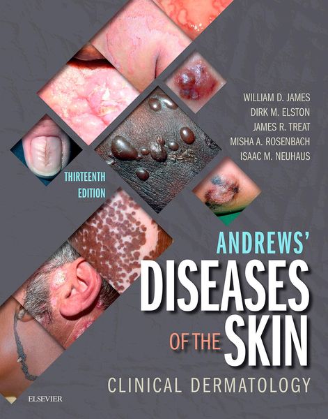 Produktbild: Andrews' Diseases of the Skin