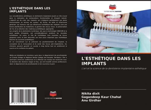 Produktbild: L'esth&eacute;tique Dans Les Implants