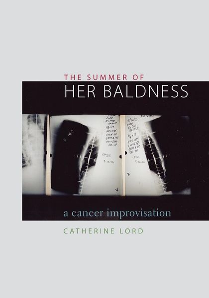 Produktbild: The Summer of Her Baldness