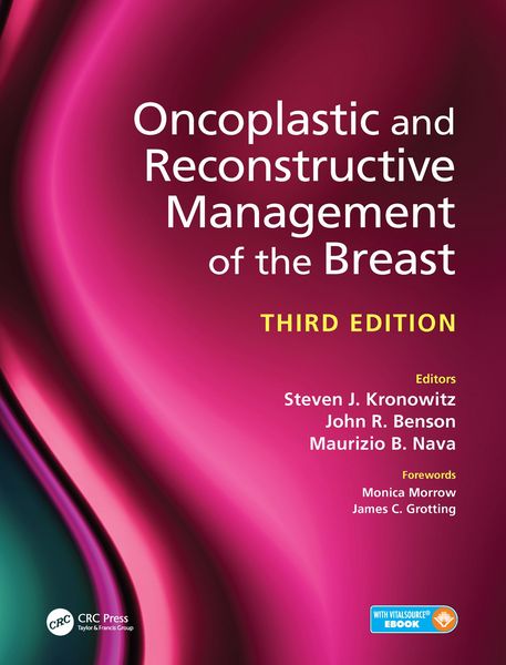 Produktbild: Oncoplastic and Reconstructive Management of the Breast, Third Edition