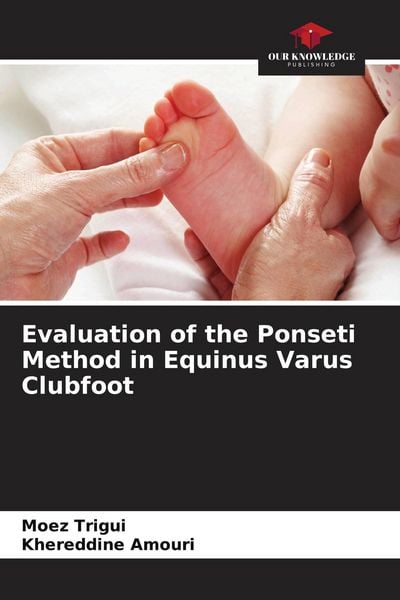 Produktbild: Evaluation of the Ponseti Method in Equinus Varus Clubfoot
