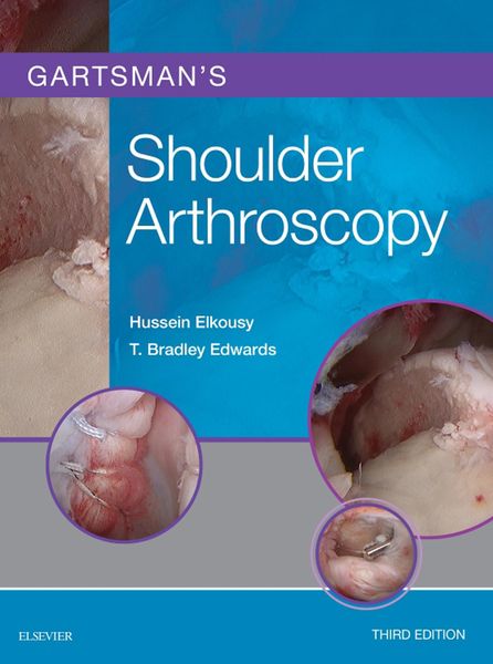 Produktbild: Gartsman's Shoulder Arthroscopy E-Book